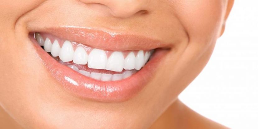 What You Need to Know about Teeth Whitening